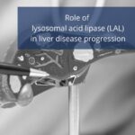 Role of LAL liver disease