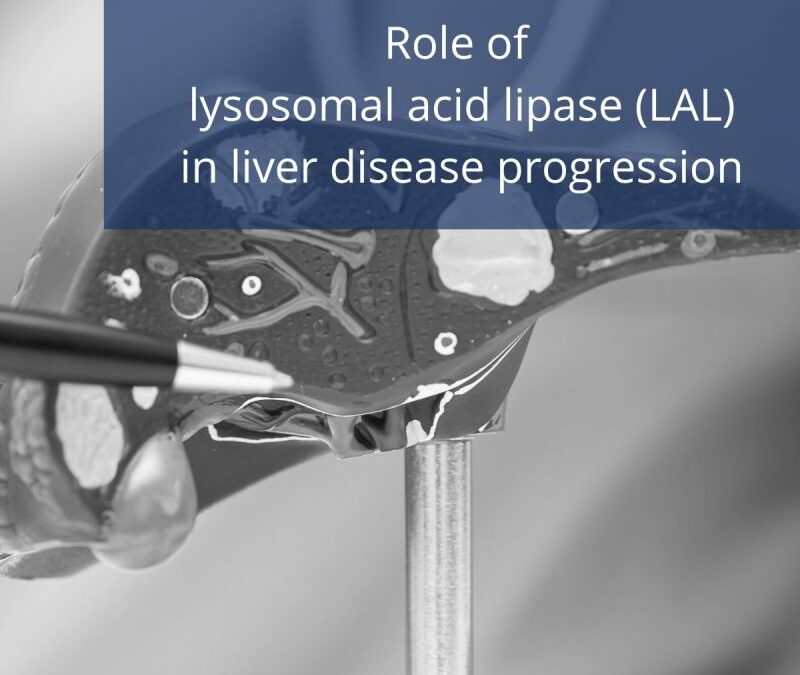 Role of LAL liver disease